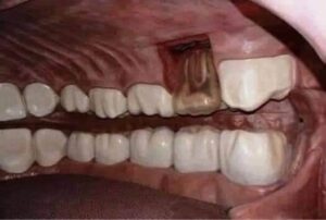 غرفة لأسنان الإنسان